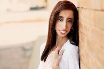  lizzie velasquez, la mujer más fea del mundo