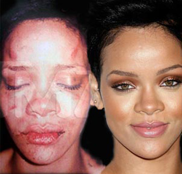 Foto que circuló de Rihanna tras ser golpeada por Brown en 2009