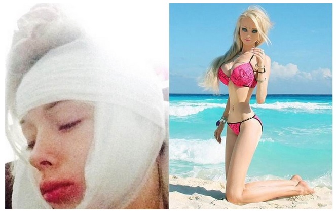 barbie humana golpeada