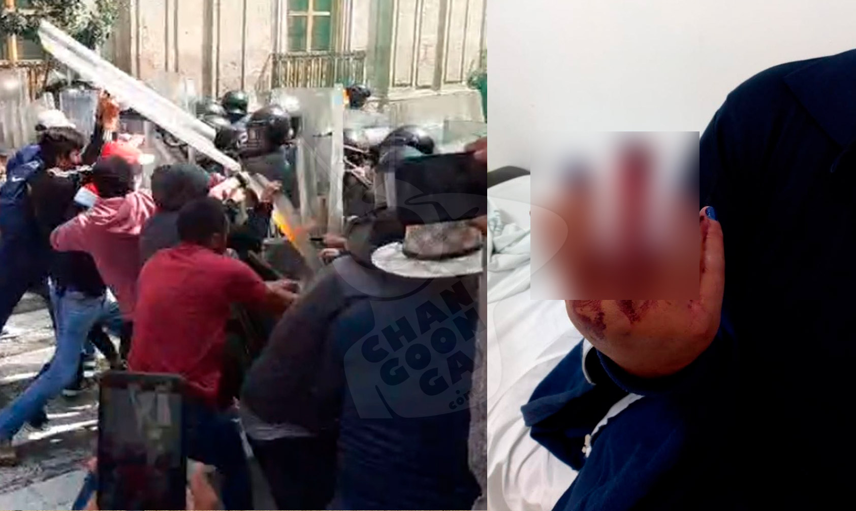 Morelia Mujer Polic A Pierde Parte De Un Dedo Tras Enfrentamiento Vs