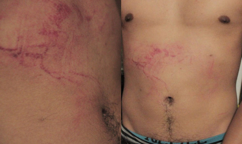 agresion-chavo-gay-Morelia