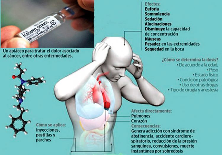 Fentanilo Si Sobrepasas Un Miligramo Puede Ser Mortal 