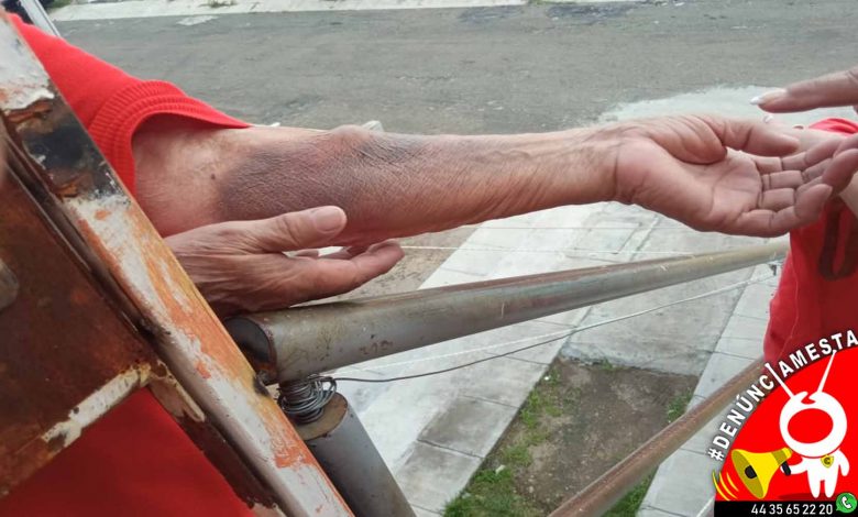 #Denúnciamesta Abuelita es maltratada por su hijo en Hacienda del Sol